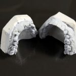 What To Do With Old Dentures